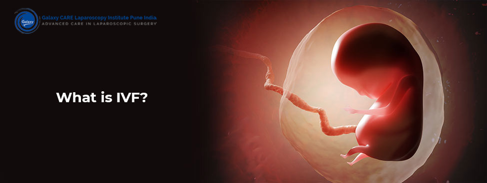 What is IVF? What is IVF?