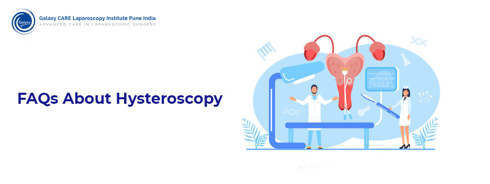 FAQs About Hysteroscopy