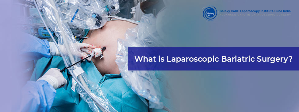 What is Bariatric Surgery? (Laparoscopic Surgery For Weight Loss)