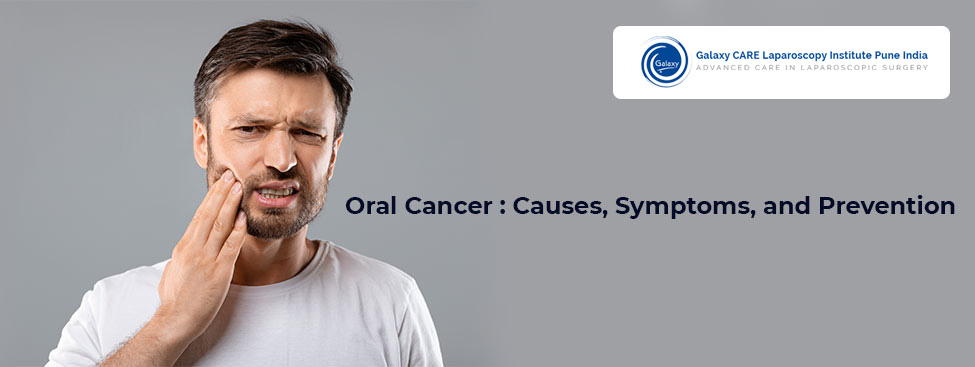Oral Cancer: Causes, Symptoms, and Prevention