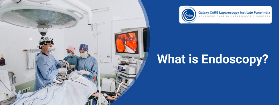 What is Endoscopy?