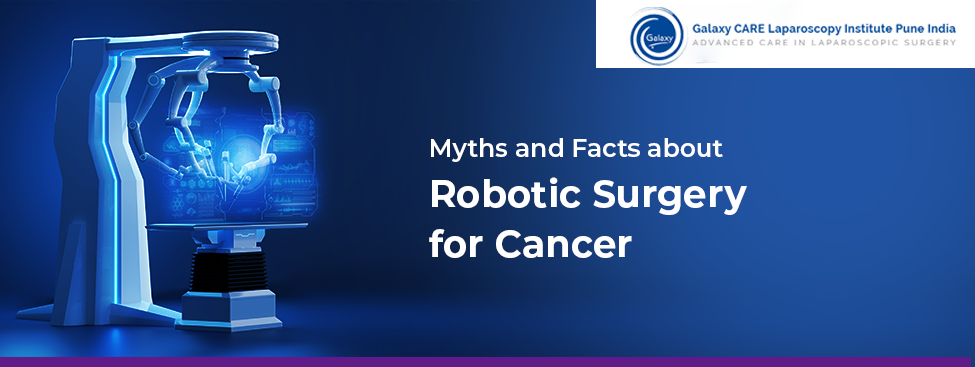 Myths and Facts about Robotic Surgery for Cancer