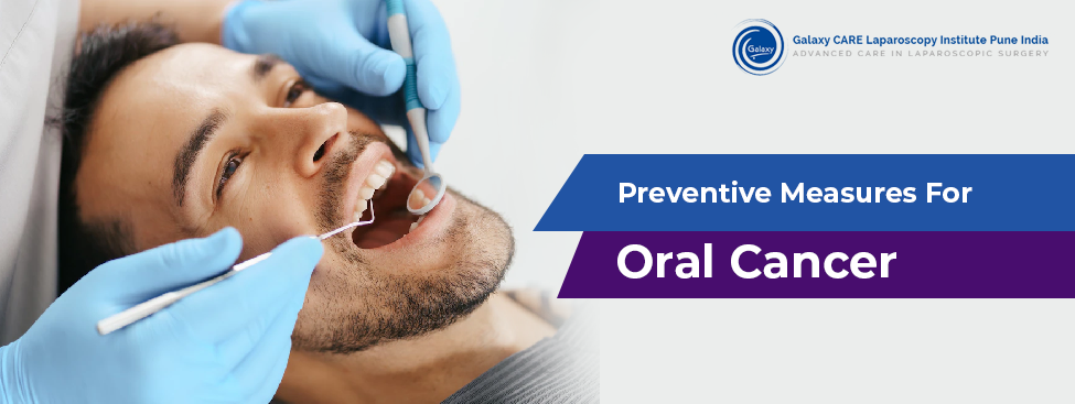 Preventive Measures For Oral Cancer