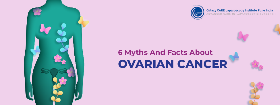 6 Myths And Facts About Ovarian Cancer