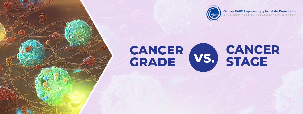 Cancer Grade vs. Cancer Stage: What’s The Difference?
