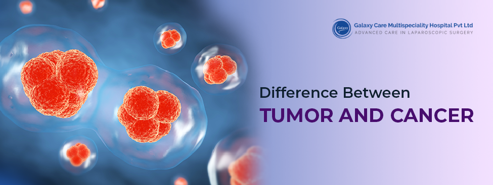 Difference Between Tumor And Cancer