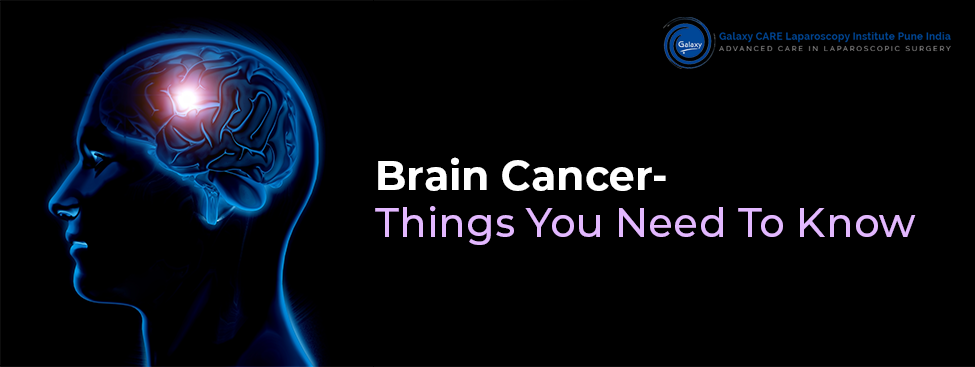 Brain Cancer- Things You Need To Know
