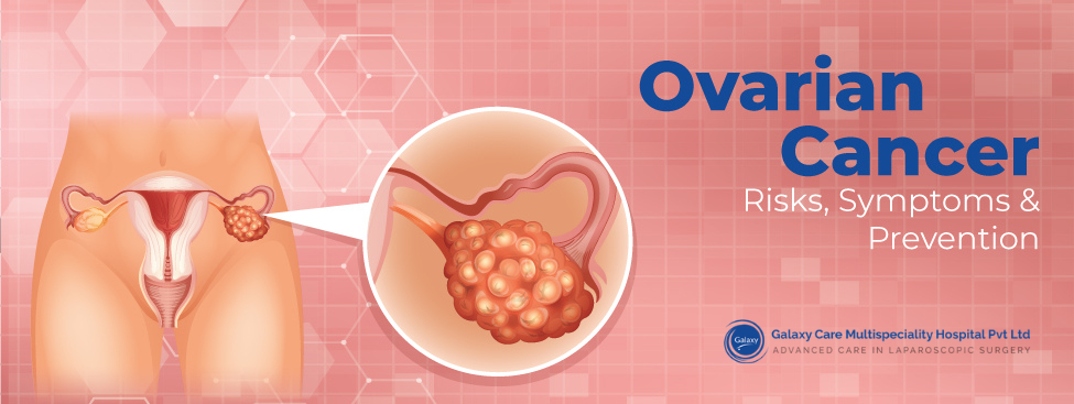 Ovarian cancer - risk, factor, Galaxy Care