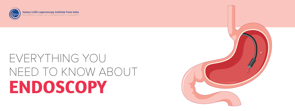 EVERYTHING YOU NEED TO KNOW ABOUT ENDOSCOPY