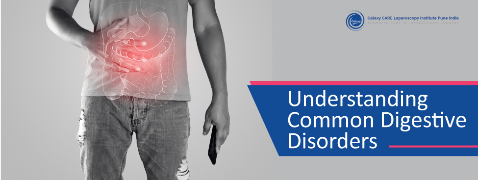 UNDERSTANDING COMMON DIGESTIVE DISORDERS