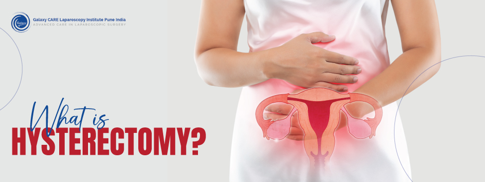 WHAT IS HYSTERECTOMY? 