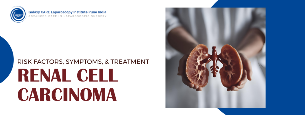 Renal Cell Carcinoma: Understanding the Risk Factors, Symptoms & Treatment