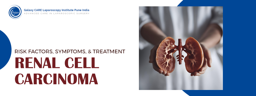 Renal Cell Carcinoma