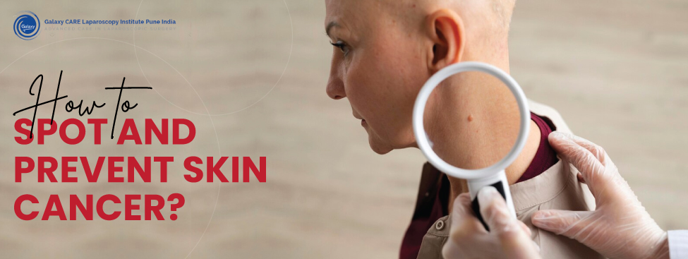 HOW TO SPOT AND PREVENT SKIN CANCER?