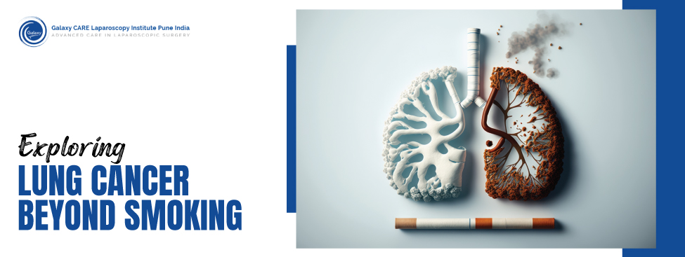EXPLORING THE HIDDEN CULPRITS: LUNG CANCER BEYOND SMOKING