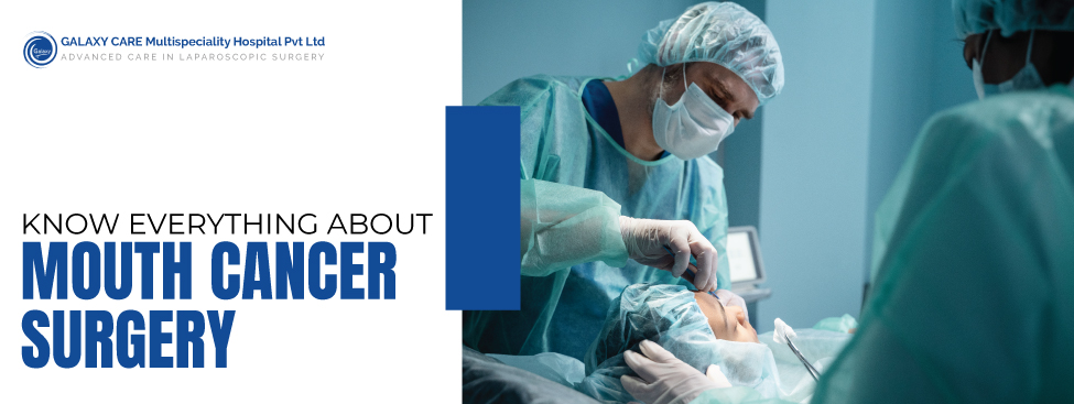 Mouth Cancer Surgery: What You Need to Know Before and After the Procedure Mouth Cancer Surgery: What You Need to Know Before and After the Procedure