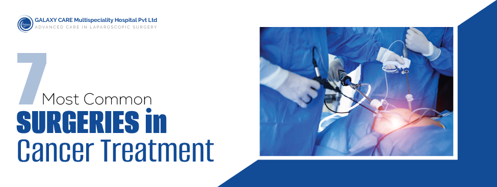 7 Most Common Surgeries in Cancer Treatment (And What to Expect) 7 Most Common Surgeries in Cancer Treatment (And What to Expect)