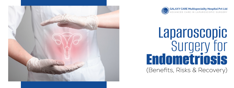 Lap Gynae Surgery for Endometriosis: Benefits & Recovery
