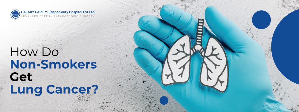 Lung Cancer Specialist: Why Non-Smokers Are at Risk