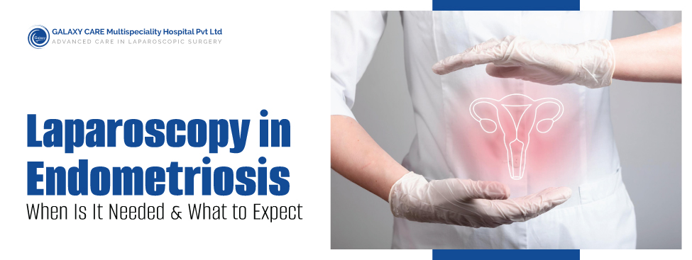 Laparoscopy in Endometriosis: When Is It Needed & What to Expect Laparoscopy in Endometriosis: When Is It Needed & What to Expect