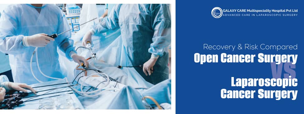 Open Cancer Surgery vs Laparoscopic Cancer Surgery: Recovery & Risk Compared Open Cancer Surgery vs Laparoscopic Cancer Surgery: Recovery & Risk Compared
