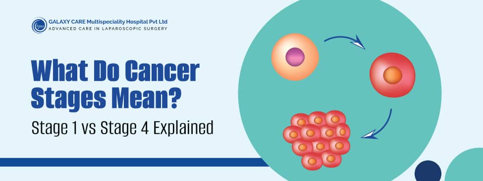 Cancer Stage 1 vs Stage 4 Explained In Detail Cancer Stage 1 vs Stage 4 Explained In Detail