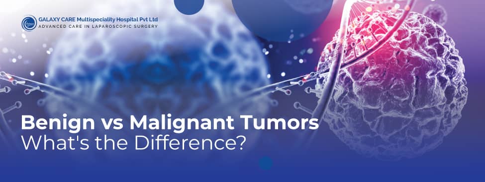 Benign vs Malignant Tumors – Know the difference Benign vs Malignant Tumors – Know the difference