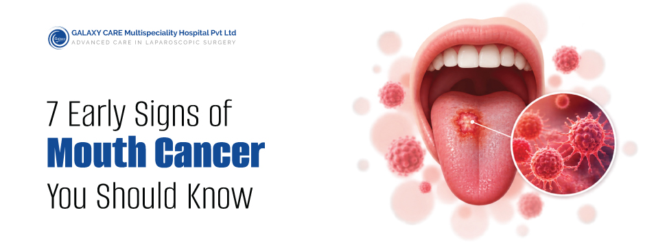 7 Early Signs of Mouth Cancer You Should Know