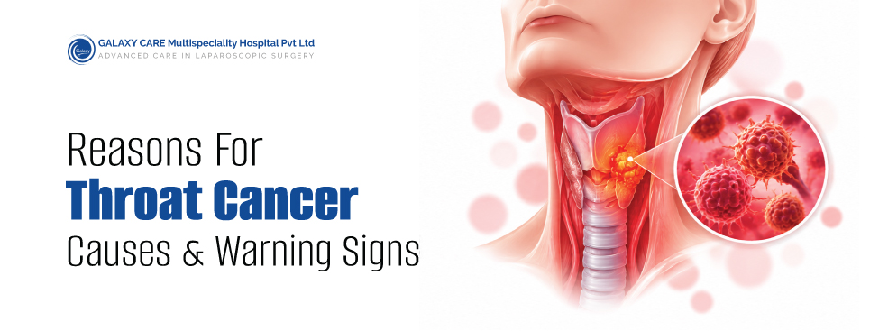 Reasons for Throat Cancer: What Causes It and What Warning Signs to Watch For