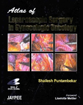 Atlas of Minimal Access Surgery in Oesophageal Cancer